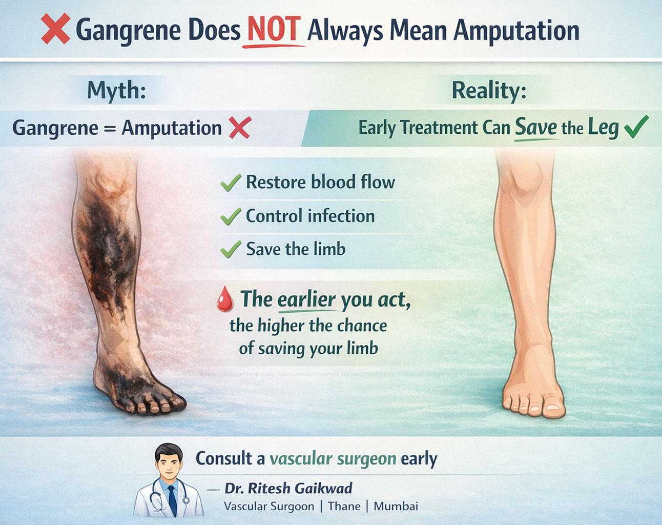 Dr. Ritesh Gaikwad Vascular surgeon and Endo Vascular surgeon