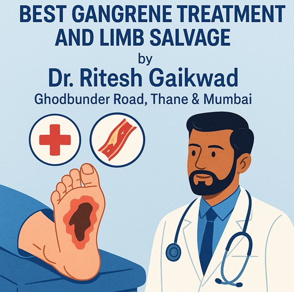Best Gangrene Treatment and Limb Salvage by Dr. Ritesh Gaikwad, Ghodbunder road, Thane & Mumbai Best Gangrene Treatment and Limb Salvage by Dr. Ritesh Gaikwad, Ghodbunder road, Thane & Mumbai
