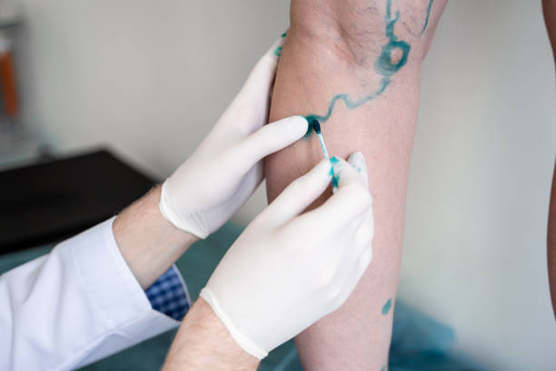 Best Vascular & Endovascular Surgeon in Navi Mumbai Best Vascular & Endovascular Surgeon in Navi Mumbai