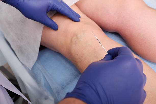 vascular surgery best vascular surgeon in vasant vihar