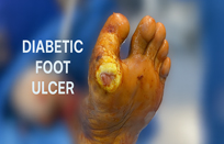 diabetic foot infections treatment in thane