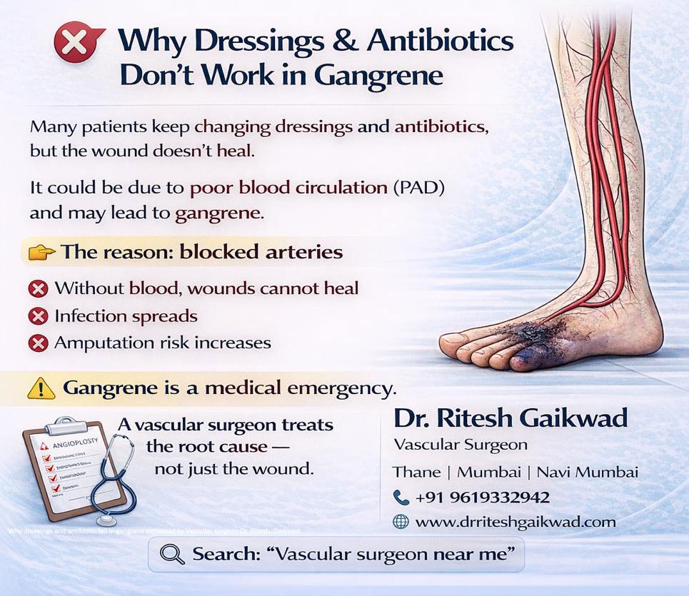 Dr. Ritesh Gaikwad Vascular surgeon and Endo Vascular surgeon