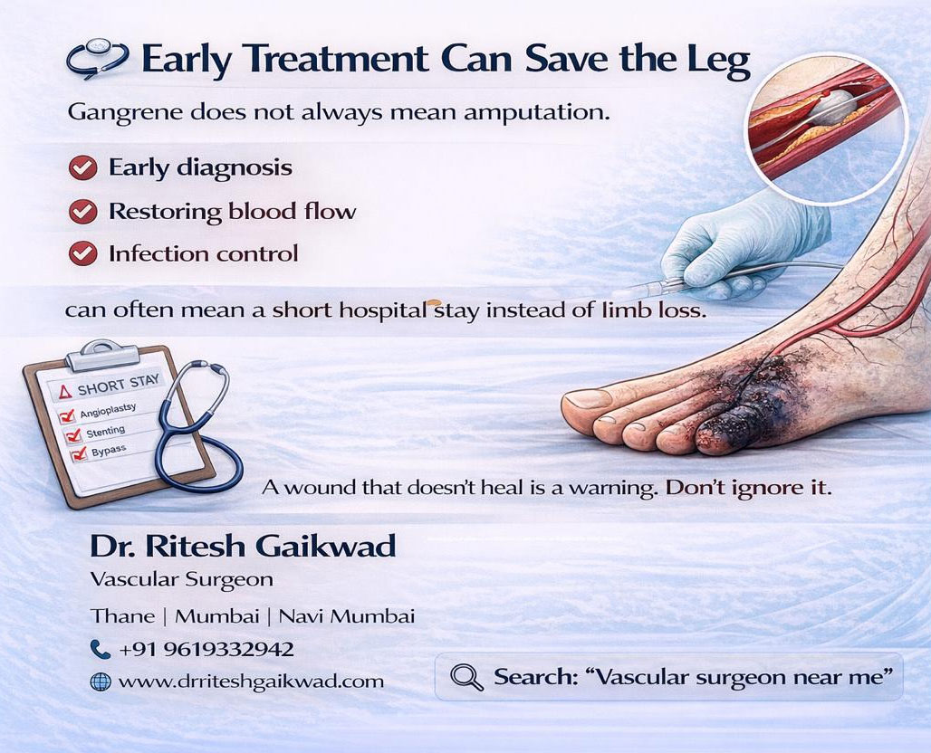 Dr. Ritesh Gaikwad Vascular surgeon and Endo Vascular surgeon