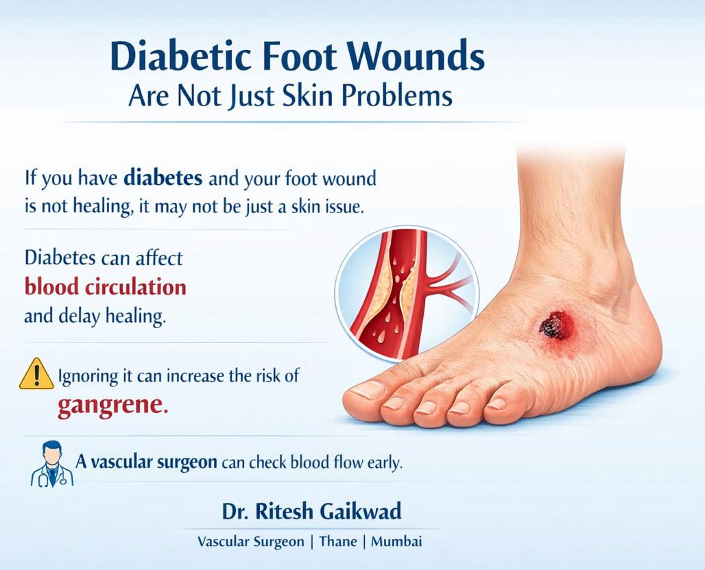 Dr. Ritesh Gaikwad Vascular surgeon and Endo Vascular surgeon