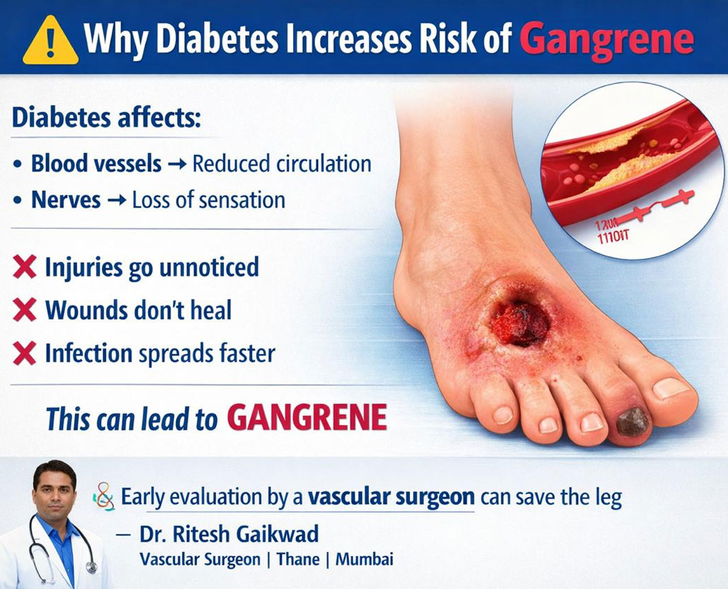 Dr. Ritesh Gaikwad Vascular surgeon and Endo Vascular surgeon