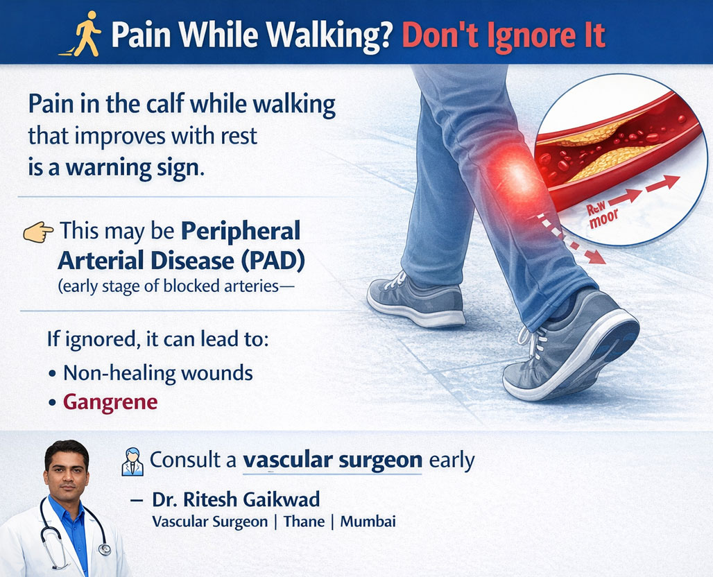 Dr. Ritesh Gaikwad Vascular surgeon and Endo Vascular surgeon